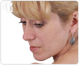 High testosterone levels will exhibit masculine physical characteristics in women