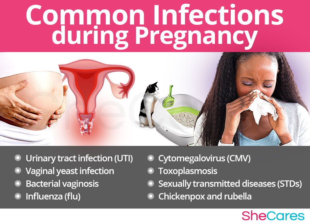Common Infections during Pregnancy