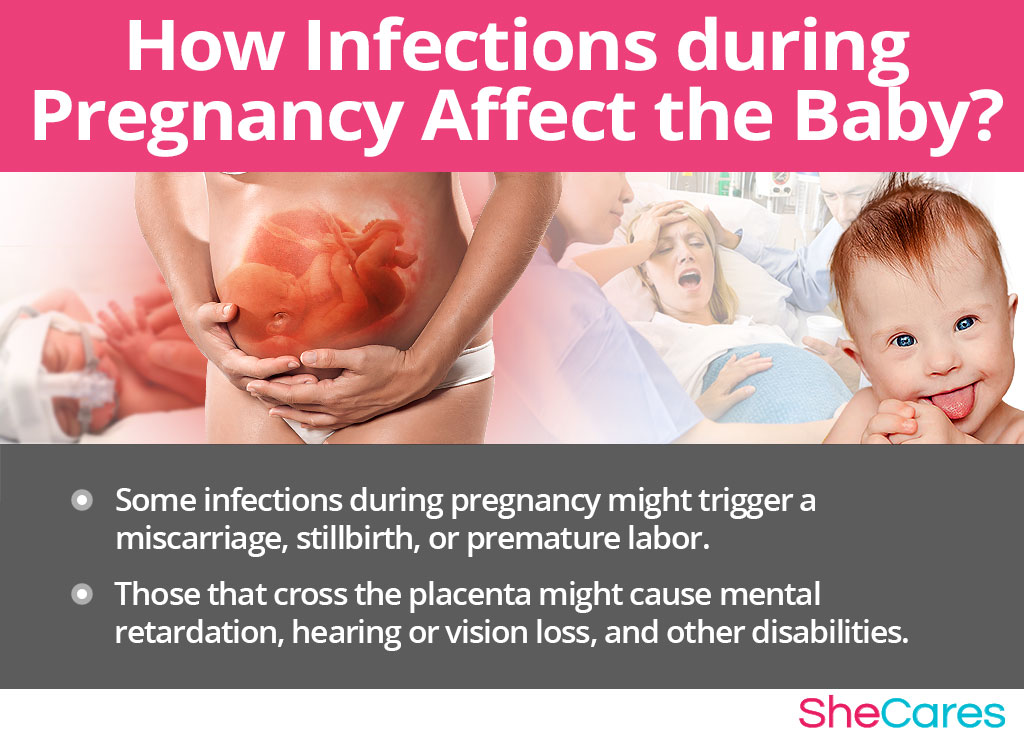 How Infections during Pregnancy Affect the Baby