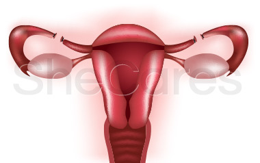 How to Treat Your Hormonal Imbalance After a Tubal Ligation