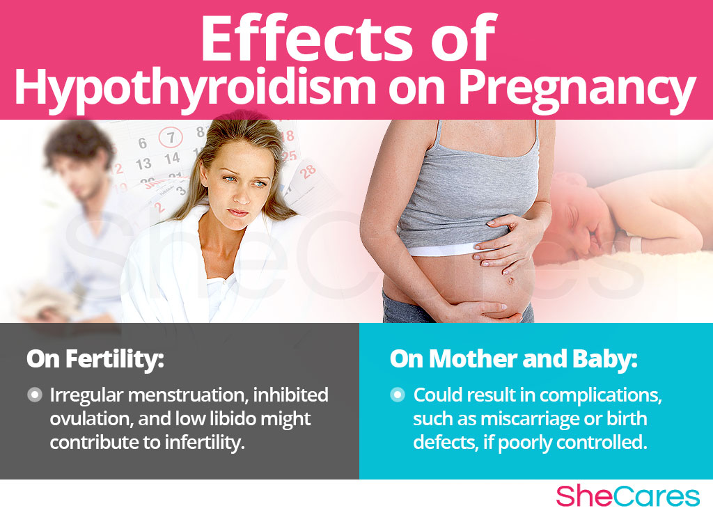 Effects of Hypothyroidism on Conception and Pregnancy