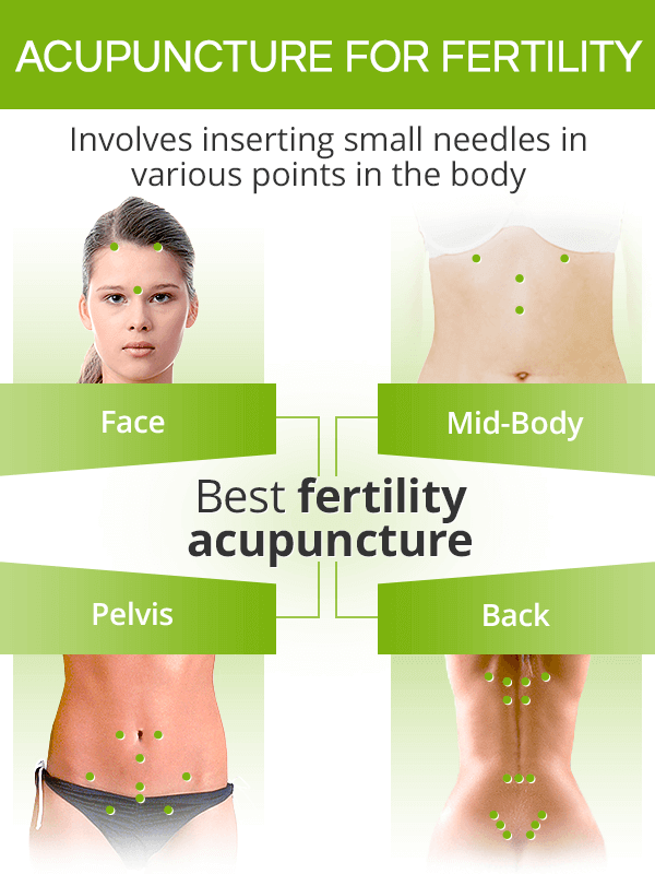 Acupuncture for fertility