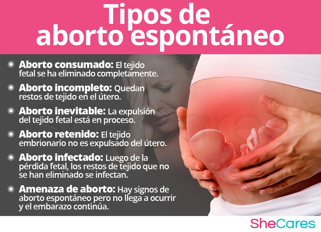 Tipos de aborto espontáneo