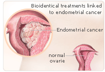 BioIdentical Hormones