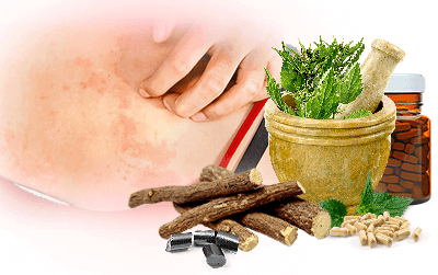 4 Natural Ways to Relieve Allergies