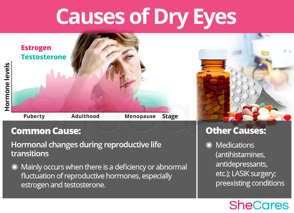 Causes of Dry Eyes