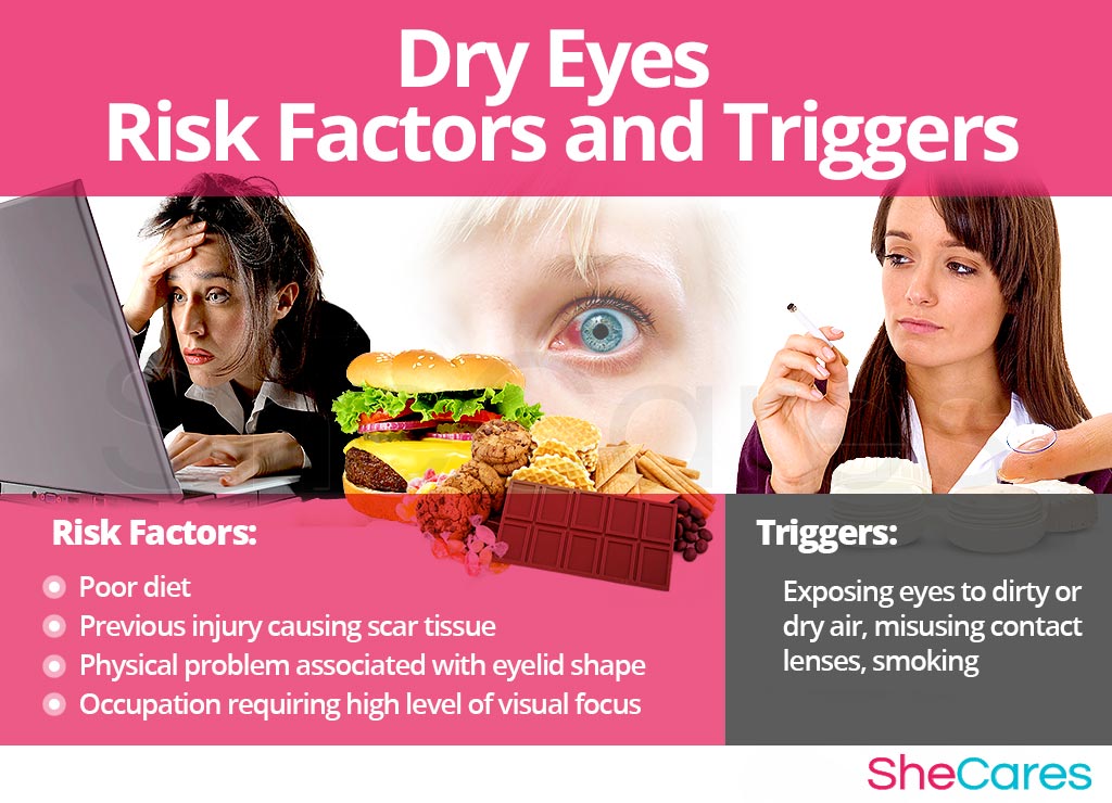 Dry Eyes - Risk Factors and Triggers