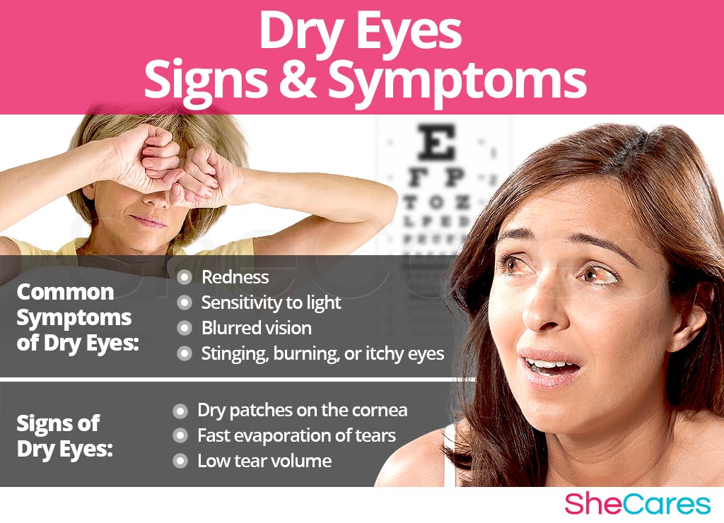 Dry Eyes - Signs and Symptoms