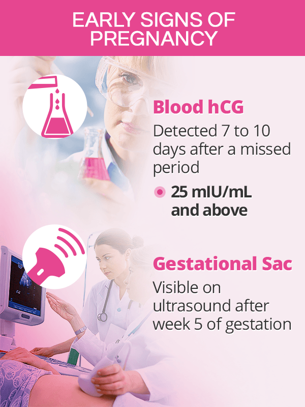 Early signs of pregnancy