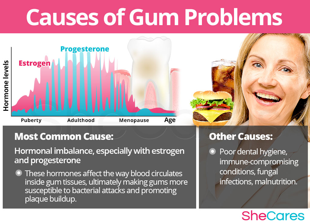 Causes of Gum Problems