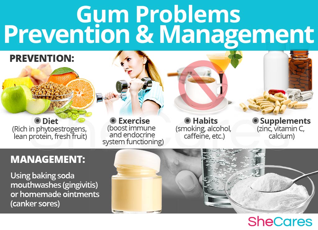 Gum Problems - Prevention and Management