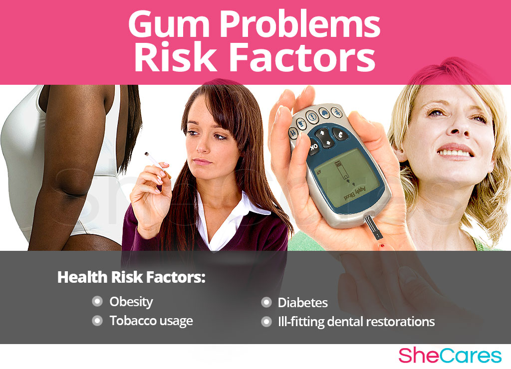 Gum Problems - Risk Factors and Triggers