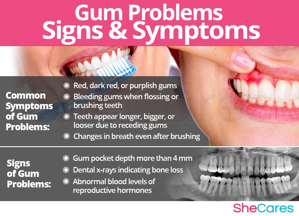 Gum Problems - Signs and Symptoms