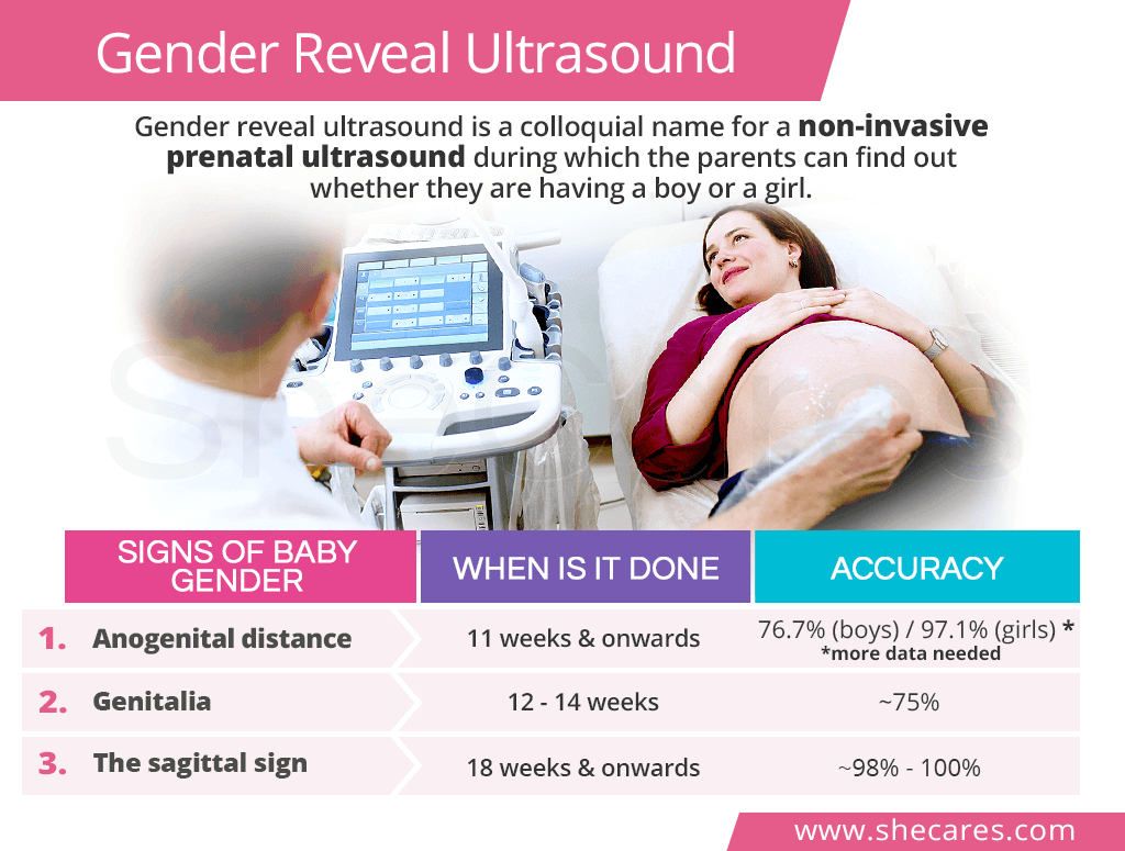 Gender reveal ultrasound
