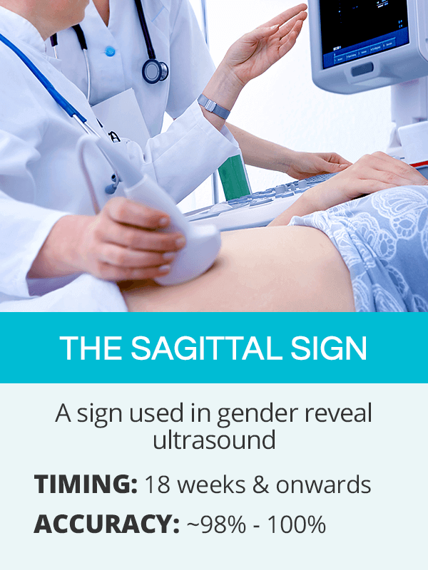 sagittal sign for gender reveal