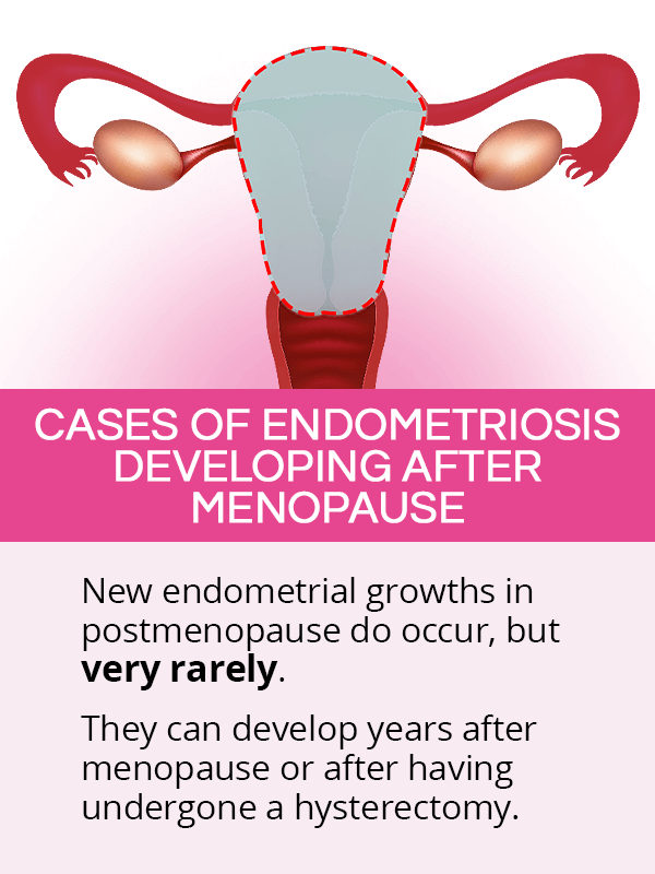 Cases of endometriosis developing after menopause