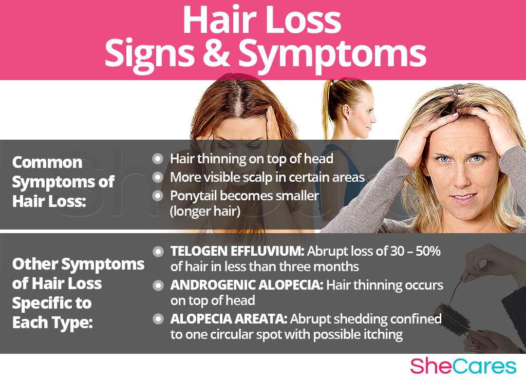 Hair Loss - Signs and Symptoms