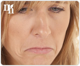 Mood swings and depression are psychological symptoms of increased hormones levels