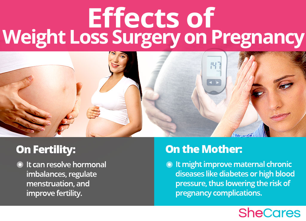 Effects of Weight Loss Surgery on Getting Pregnancy