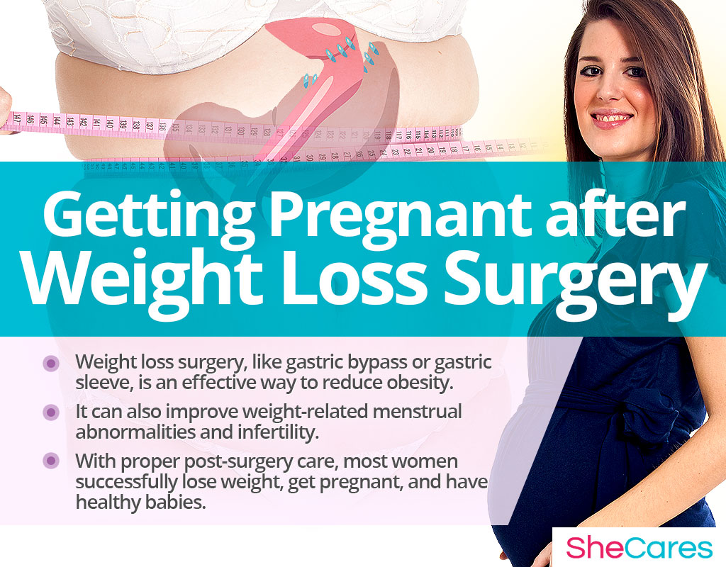 Getting Pregnant after Weight Loss Surgery