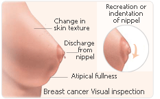 Progesterone nippel