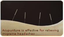 acupunture is effective for relieving migraine headaches