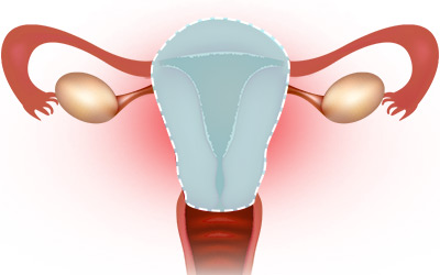 How to Balance Your Hormones after a Hysterectomy