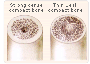 hrt weakbone