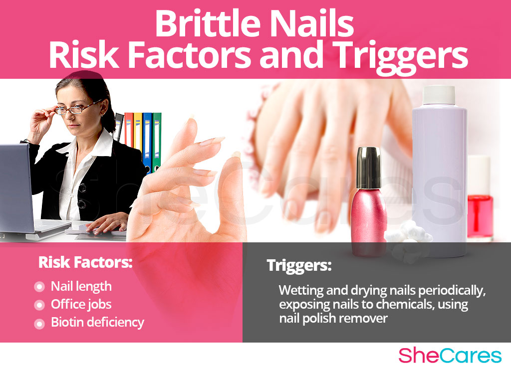 Brittle Nails - Risk Factors and Triggers