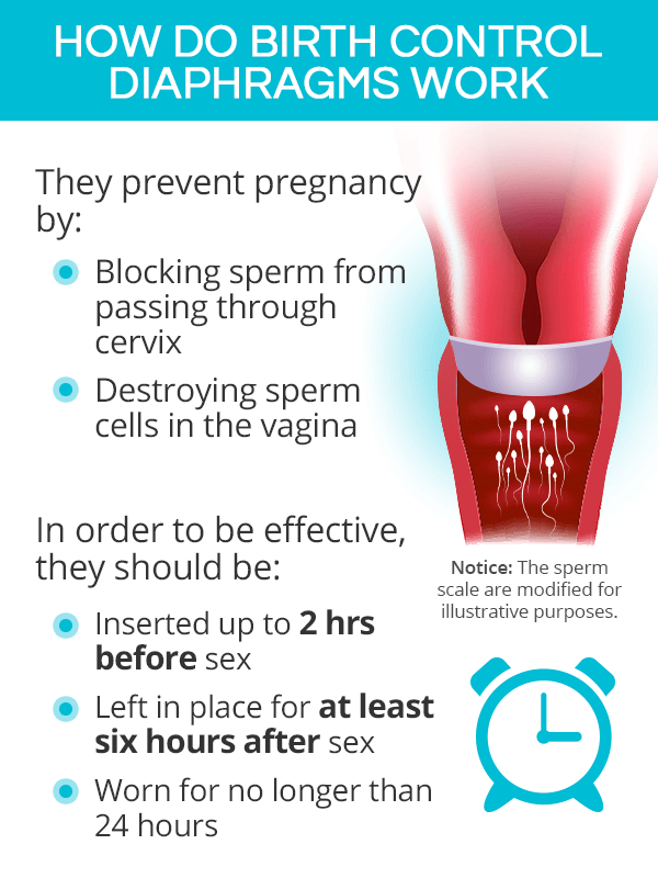 How do birth control diaphragms work