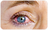 What side effects are associated with hormone replacement therapy?