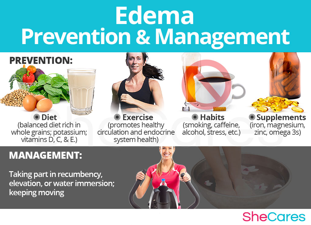 Edema - Prevention and Management