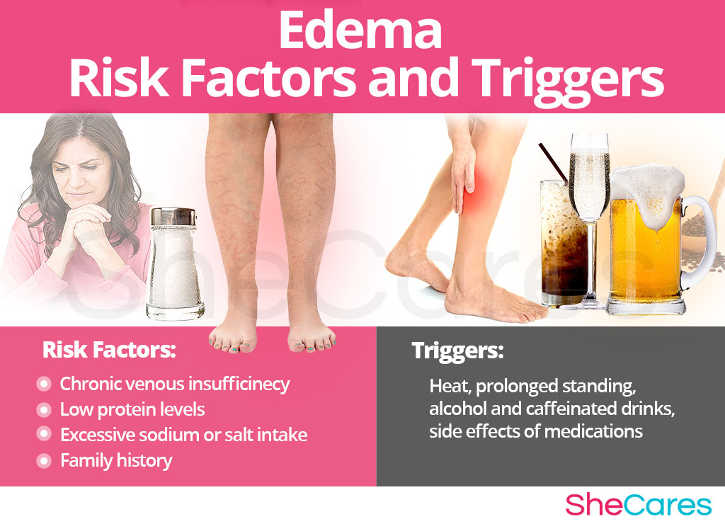 Edema - Risk Factors and Triggers