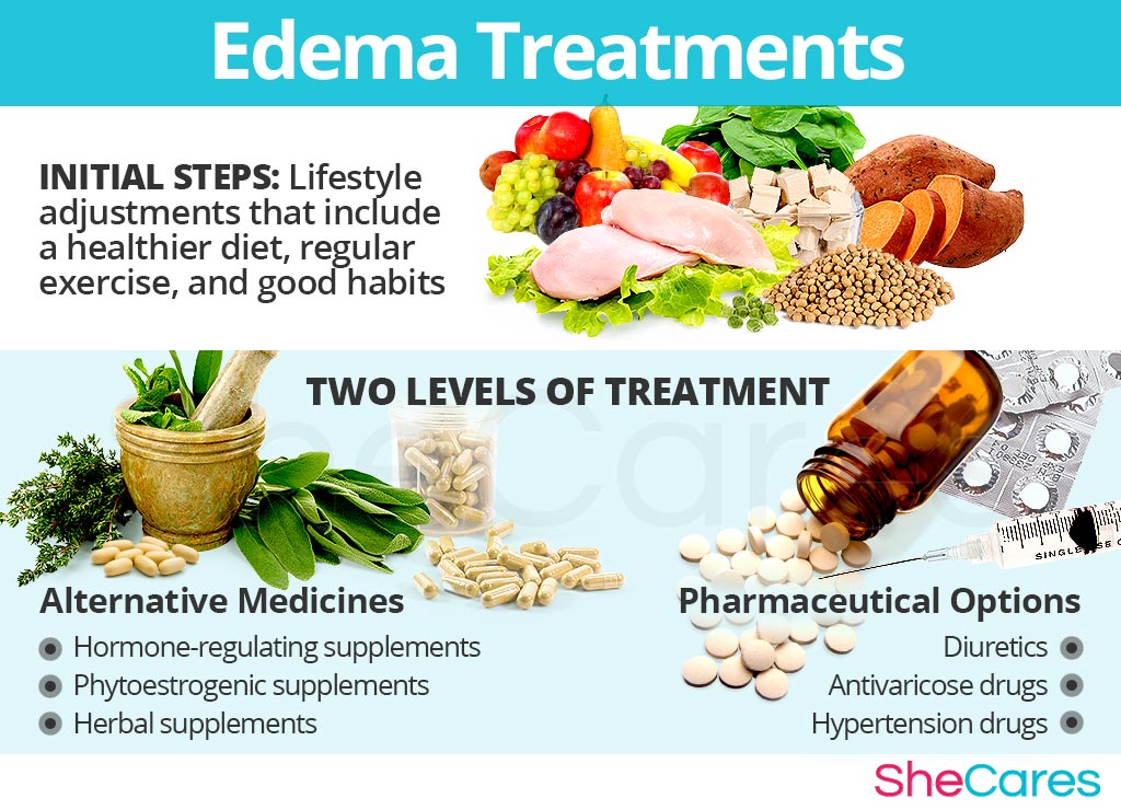 Edema Treatments