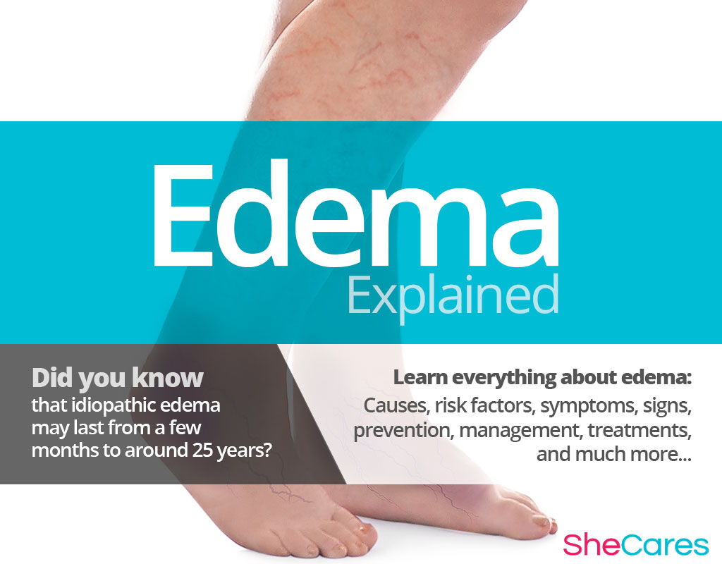 Edema