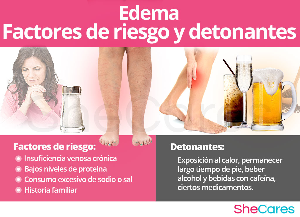 Edema - Factores de riesgo y detonantes