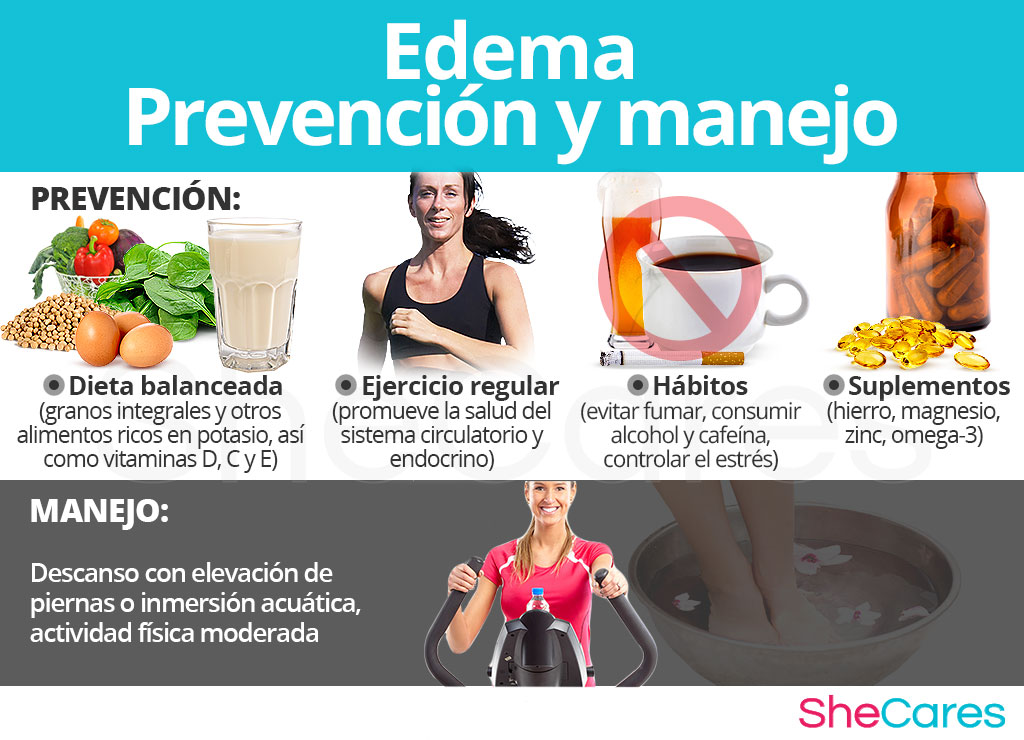 Edema - Prevención y manejo