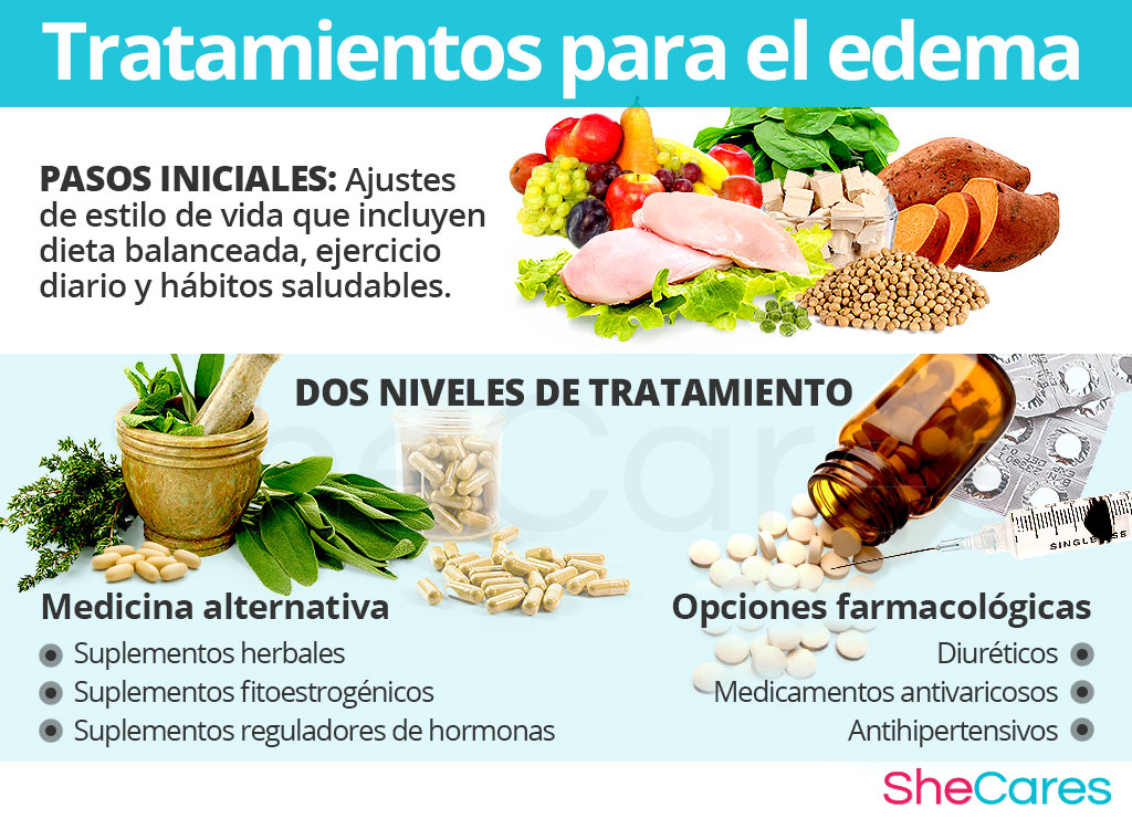 Tratamientos para el edema