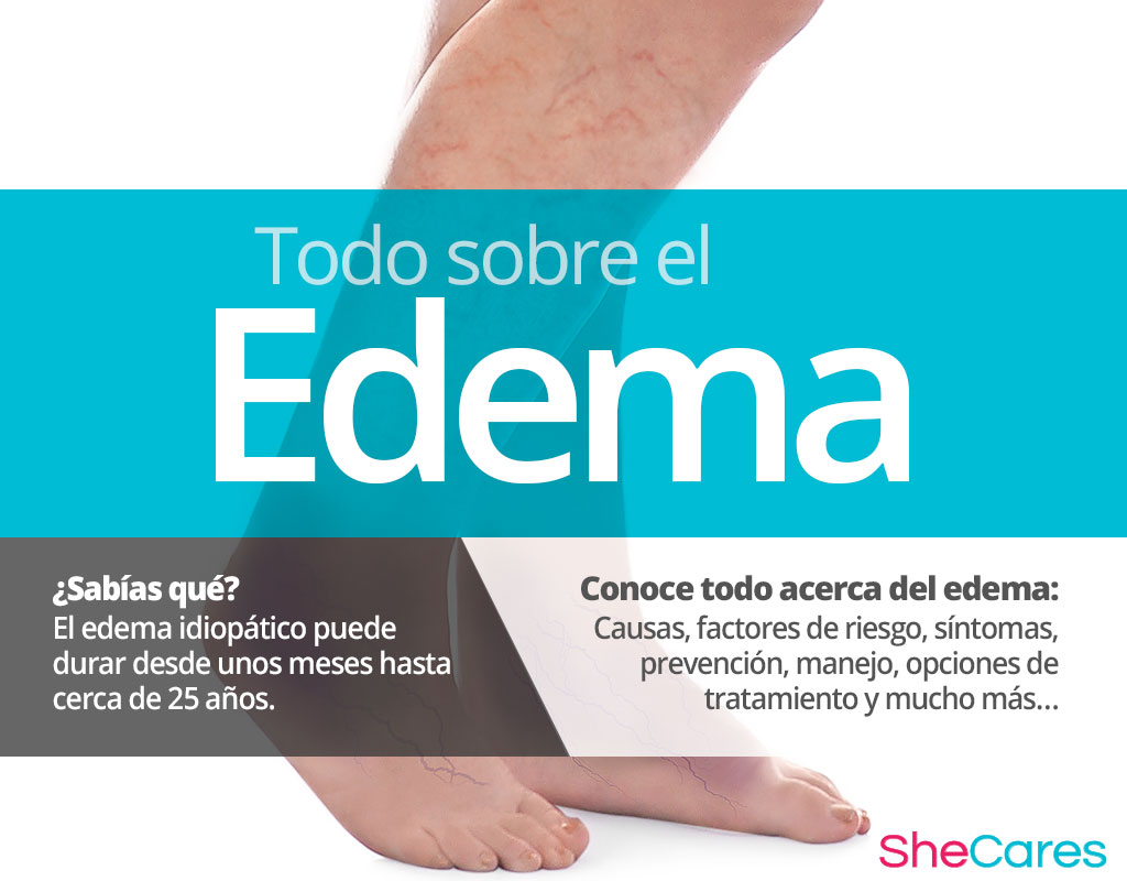 Edema