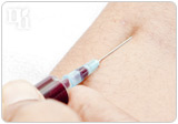 Blood test is one of types of tests available for measuring progesterone levels.
