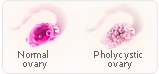estrogen cholesterol