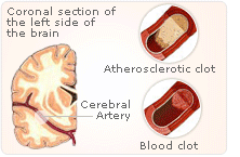 natural hormones brain