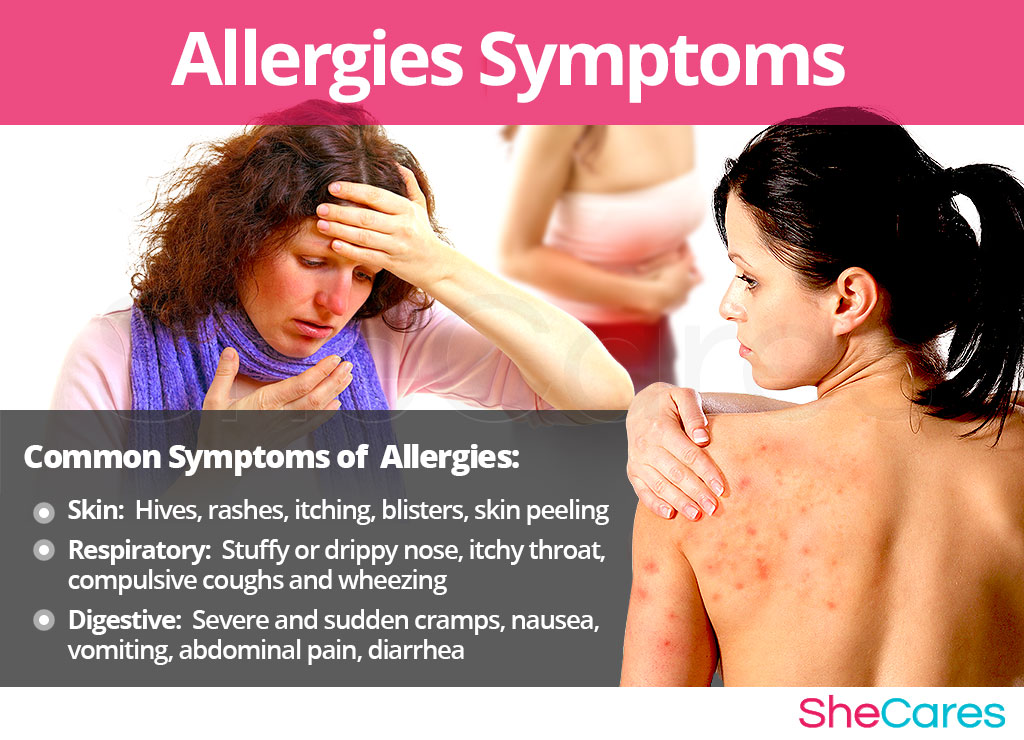 Allergies - Signs and Symptoms