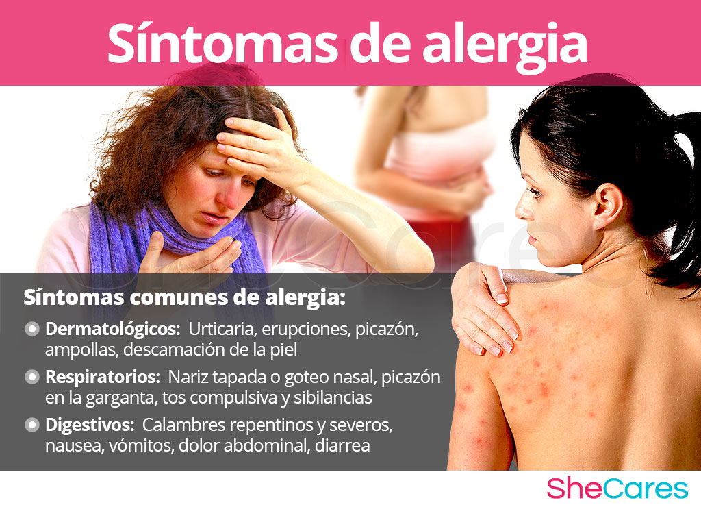 Síntomas de alergia en mujeres