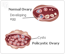 Ovaries produce estrogen, progesterone, and also androgens.