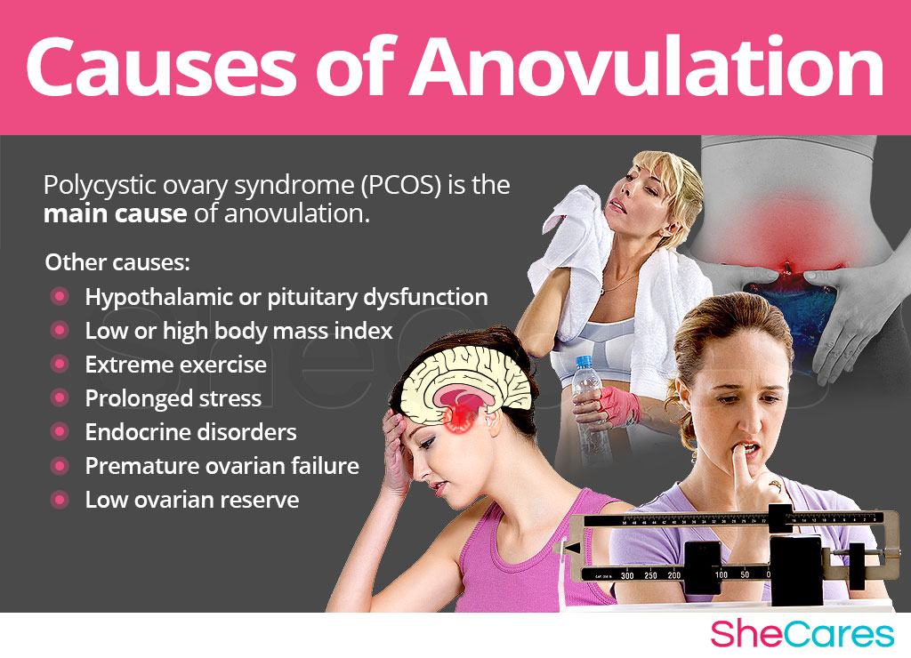 Anovulation causes