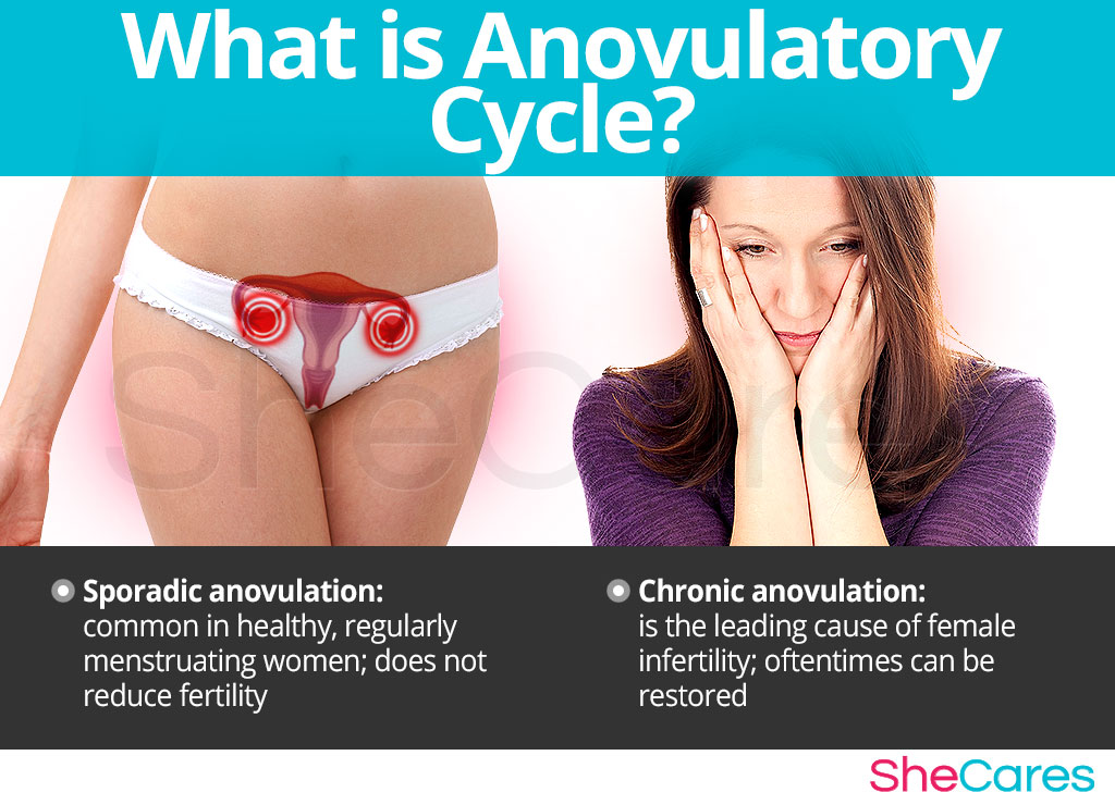 Anovulatory cycle