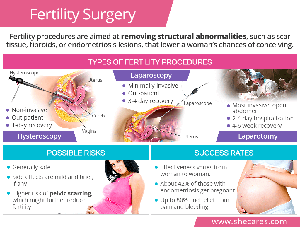 Fertility surgery
