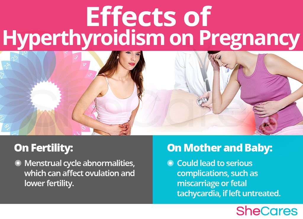 Effects of Hyperthyroidism on Pregnancy