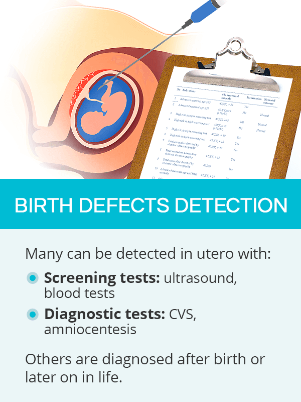 Birth defects detection